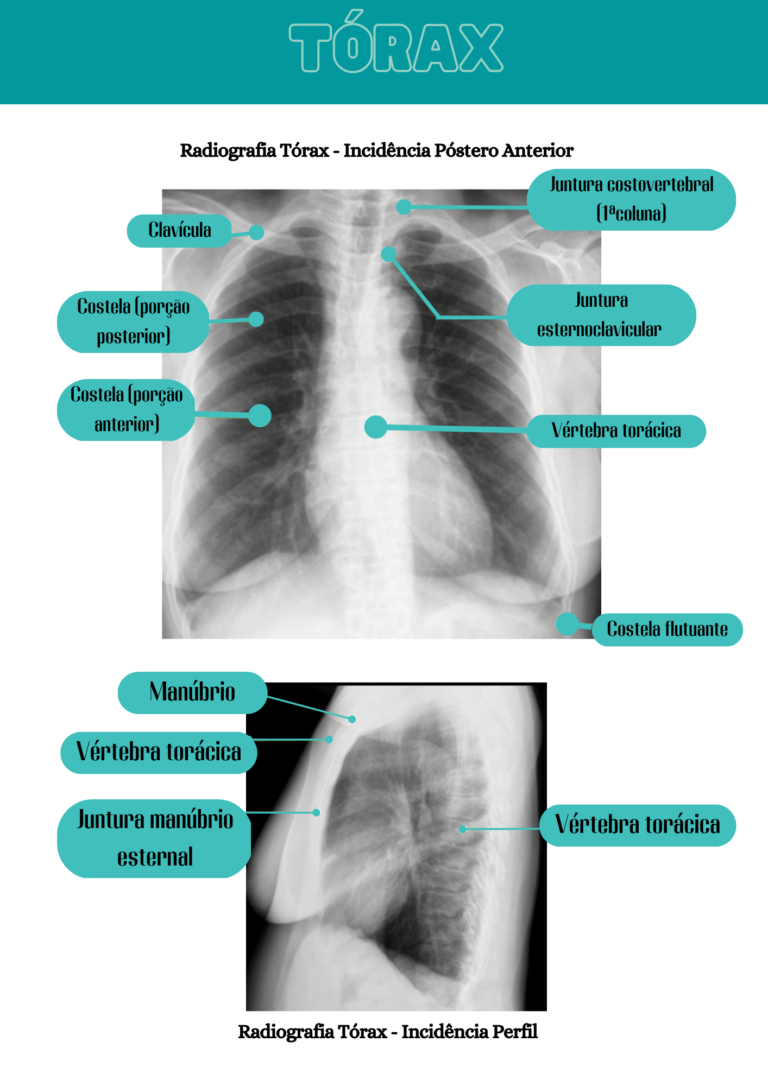 Anatomia Radiológica – Mais Resumos