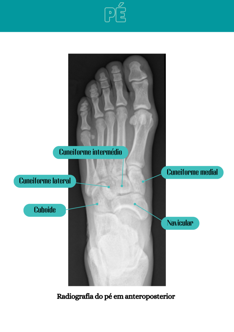 Cópia de Anatomia Radiológica (3)