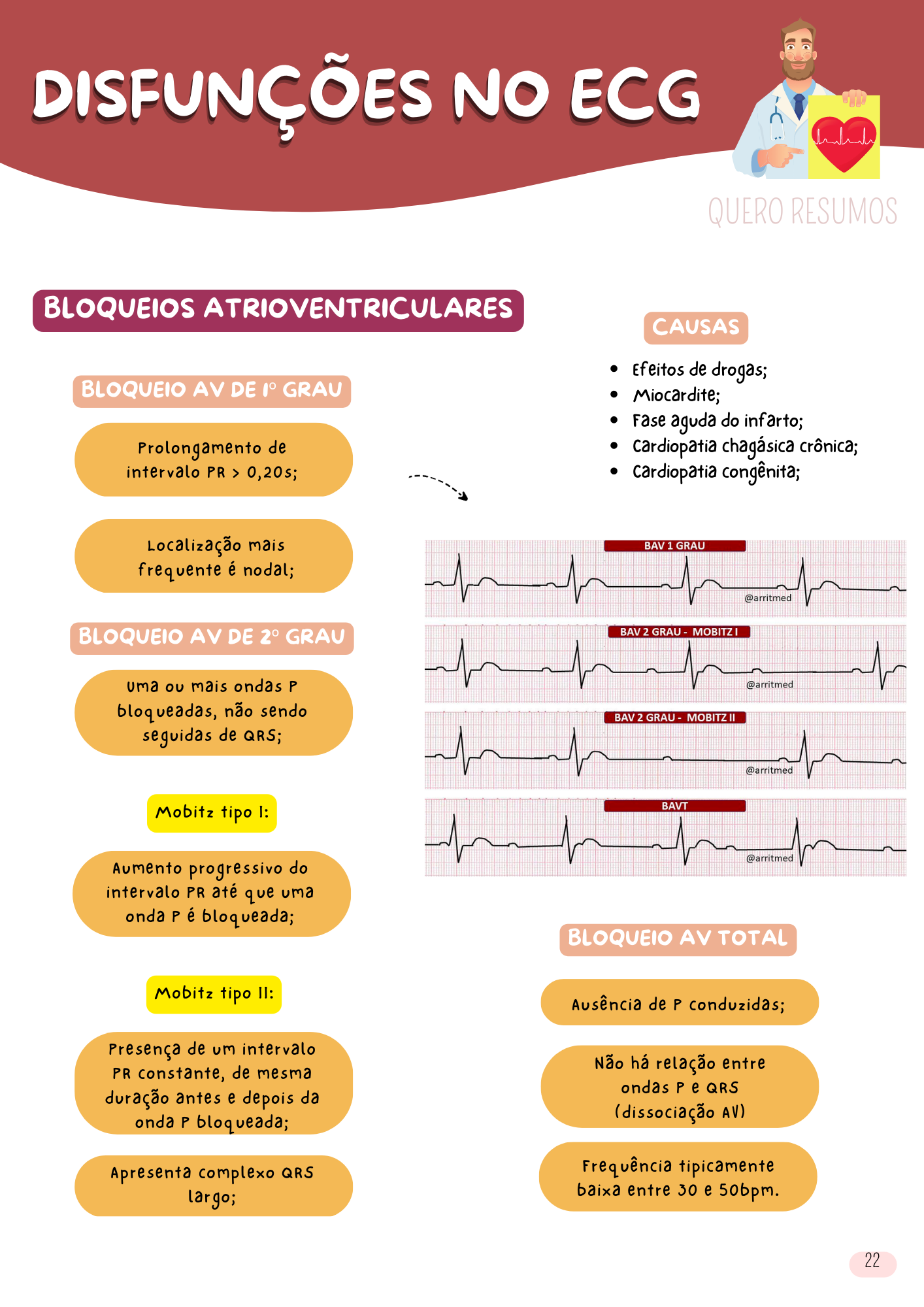 ECG (6)